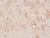 phospho-RPS6KB1(Ser427)磷酸化核糖体S6蛋白激酶抗体