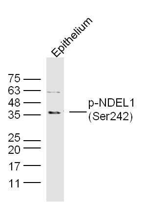 phospho-NDEL1(Ser242)磷酸化中心粒蛋白Nudel抗体