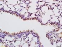 RNASE4血管生成素核糖核酸酶4抗体(肌萎缩性侧索硬化症蛋白)