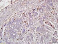 Testin肿瘤抑制基因Testin抗体