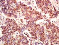 phospho-PI3 Kinase p110 beta(Ser1070)磷酸化磷脂酰肌醇激酶(PI3Kβ)抗体