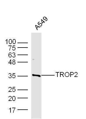 TROP2细胞表面糖蛋白Trop2抗体（胰腺癌标志物蛋白）