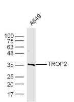 TROP2细胞表面糖蛋白Trop2抗体（胰腺癌标志物蛋白）