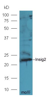 Insig2胰岛素诱导基因2抗体