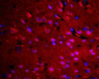 RASAL1 RAS蛋白样激活剂1抗体