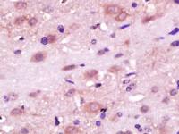 RLBP1L1视黄醛结合蛋白1抗体