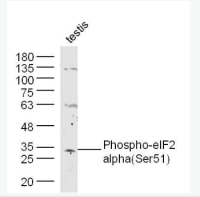 磷酸化真核启动因子2α抗体