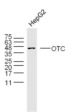 OTC鸟氨酸氨基甲酰转移酶抗体