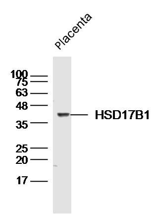 HSD17B1羟类固醇脱氢酶17β抗体