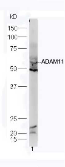 ADAM11去整合素样金属蛋白酶11抗体