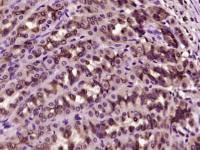 Prostaglandin dehydrogenase 1前列腺素脱氢酶1抗体