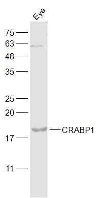 CRABP1/Retinol binding protein视黄醇结合蛋白抗体
