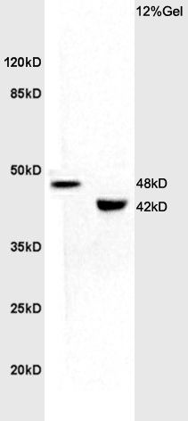 KCNN4钙激活钾通道蛋白4抗体