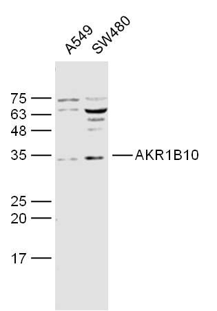 AKR1B10醛糖还原酶相关蛋白质抗体