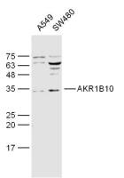 AKR1B10醛糖还原酶相关蛋白质抗体