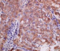 Ubiquitously expressed transcript广泛表达转录蛋白UXT抗体