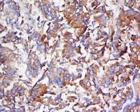 RAB5 ras癌基因家族Rab5蛋白抗体