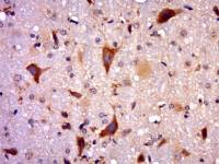 RAB8A ras癌基因家族Rab8蛋白/原癌基因c MEL抗体