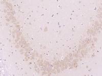 Protective protein/Cathepsin A组织蛋白酶A抗体