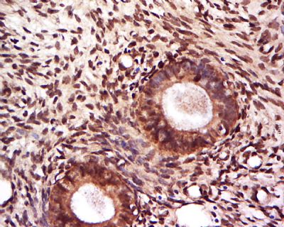 PBOV1前列腺癌和乳腺癌高表达蛋白抗体