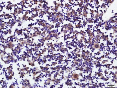 PLAG1多型性腺瘤基因1蛋白抗体