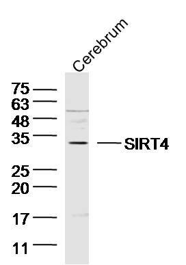 SIRT4沉默调节相关蛋白4抗体