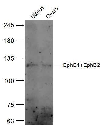 EphB1+EphB2酪氨酸蛋白激酶受体B1+B2抗体