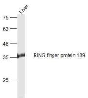RING finger protein 189环指蛋白189抗体