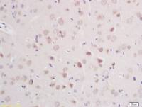 CLCN3氯离子通道蛋白3抗体