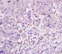 FAIM3 FAS凋亡抑制分子3抗体