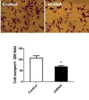 transwell细胞迁移