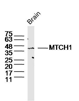 MTCH1细胞增殖诱导蛋白60（早老素相关蛋白）