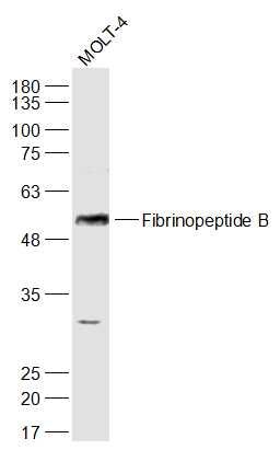 Fibrinopeptide B纤维蛋白肽B/血纤肽B抗体