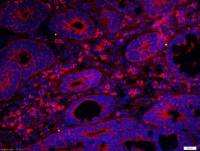 DNase II脱氧核糖核酸酶2抗体