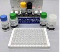 Human Heat Shock Protein 70 ELISA Kit(人热休克蛋白70 ELISA 试剂盒)