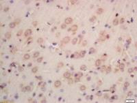 INPPL1肌醇聚磷酸盐磷酸酶样蛋白1抗体