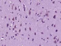 Sprouty 2快速发育生长因子同源蛋白2抗体