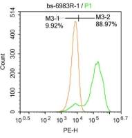 Wilms Tumor Protein肾母细胞瘤蛋白抗体