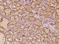 ZHX2甲胎蛋白调节蛋白1抗体