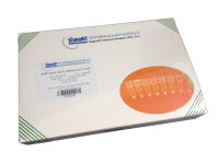 LyoDt®诺如病毒G1型干燥型荧光RT-PCR检测试剂