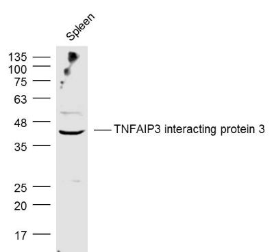 TNFAIP3 interacting protein 3肿瘤坏死因子α诱导相互作用蛋白3抗体