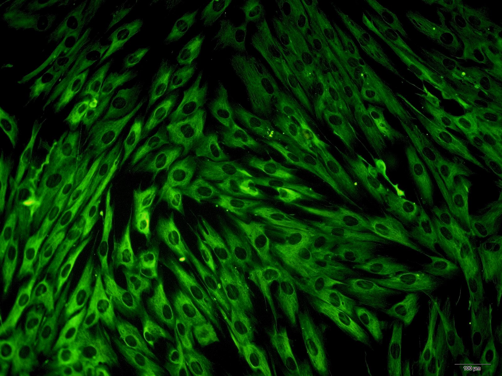 肺动脉平滑肌细胞图片