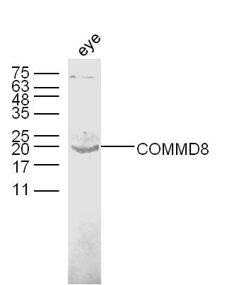 COMMD8铜代谢结构域蛋白8抗体