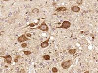 CCDC83卷曲螺旋结构域蛋白83抗体