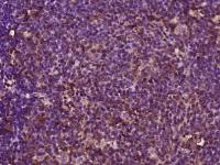 CCDC102B卷曲螺旋结构域蛋白102B抗体