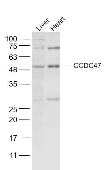 CCDC47卷曲螺旋结构域蛋白47抗体
