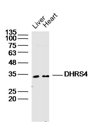 DHRS4短链脱氢酶/还原酶家族4抗体