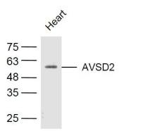 AVSD2富含半胱氨酸与表皮生长因子样蛋白2抗体