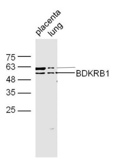 BDKRB1缓激肽B1受体抗体
