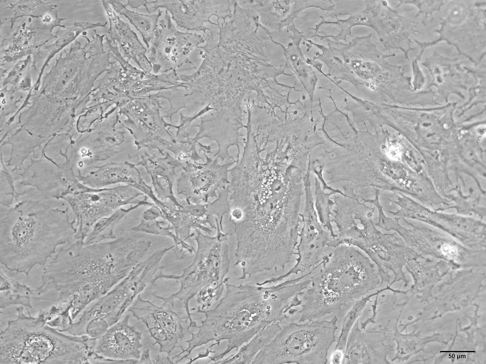 大鼠肾系膜细胞